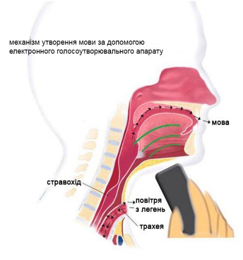 Як розмовляти з допомогою голосоутворюючого апарату
